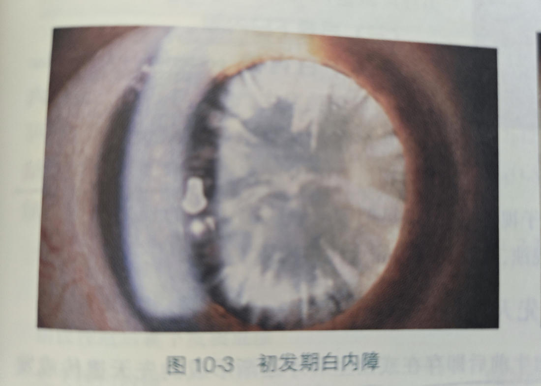 压缩图-1