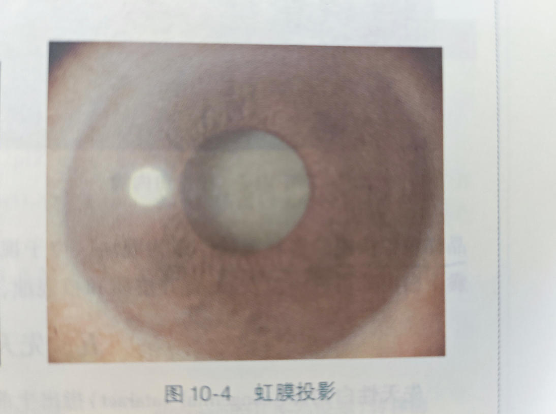 压缩图-2