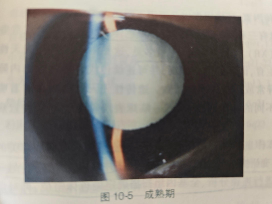 压缩图-3