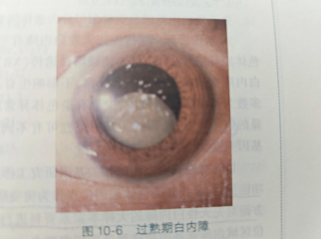 压缩图-4